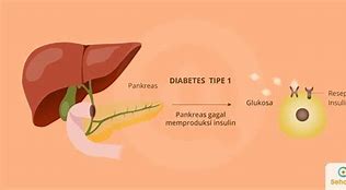 Tanda Penyakit Diabetes Type 1